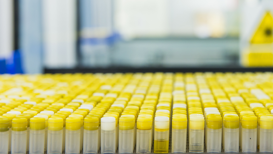 Hundreds of test tubes with yellow lids.